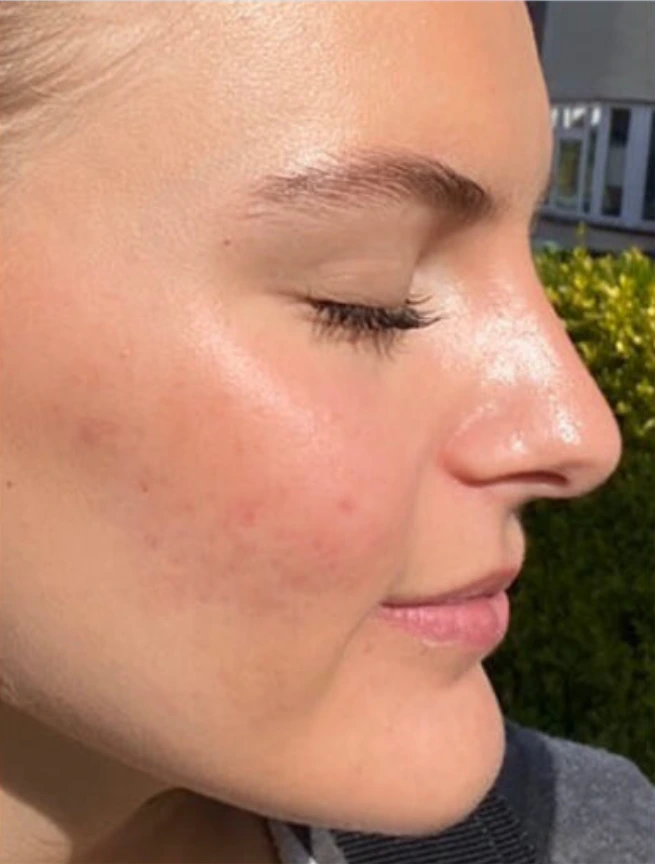 After using our products